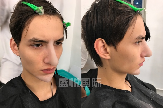 不(bù)疼的(de)“整容”秘籍！